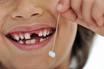 Înțelegem câte dinți de copil ar trebui să aibă un copil