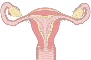 Cum sa reduci sangerarea in timpul menstruatiei?